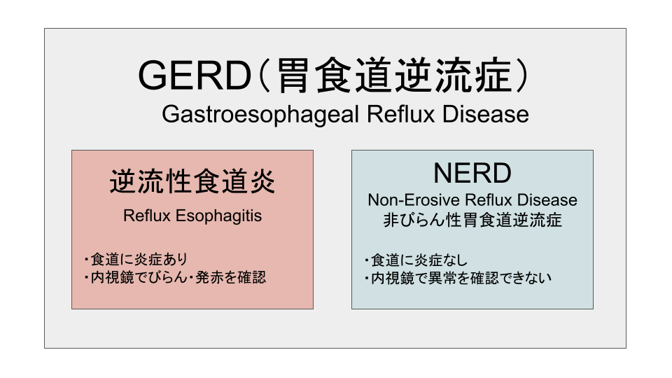 GERD,NERD,逆流性食道炎の相関図